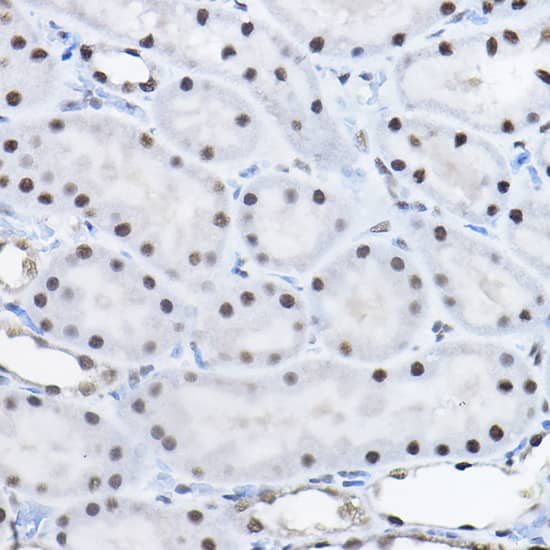 Immunohistochemistry: BCAS2 Antibody [NBP3-38090] - Immunohistochemistry analysis of paraffin-embedded Rat kidney using BCAS2 Rabbit pAb at dilution of 1:100 (40x lens). High pressure antigen retrieval performed with 0.01M Citrate Bufferr (pH 6.0) prior to IHC staining.