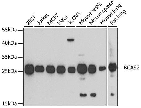 Western Blot: BCAS2 Antibody [NBP3-38090] - Western blot analysis of various lysates using BCAS2 Rabbit pAb at 1:1000 dilution.Secondary antibody: HRP-conjugated Goat anti-Rabbit IgG (H+L) at 1:10000 dilution.Lysates/proteins: 25ug per lane.Blocking buffer: 3% nonfat dry milk in TBST.Detection: ECL Basic Kit.Exposure time: 90s.