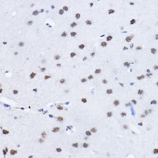 Immunohistochemistry: BCAS2 Antibody [NBP3-38090] - Immunohistochemistry analysis of paraffin-embedded Mouse brain using BCAS2 Rabbit pAb at dilution of 1:100 (40x lens). High pressure antigen retrieval performed with 0.01M Citrate Bufferr (pH 6.0) prior to IHC staining.