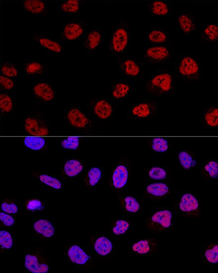 Immunocytochemistry/ Immunofluorescence: BCAS2 Antibody [NBP3-38090] - Confocal immunofluorescence analysis of U2OS cells using BCAS2 Rabbit pAb at dilution of 1:100. Blue: DAPI for nuclear staining.