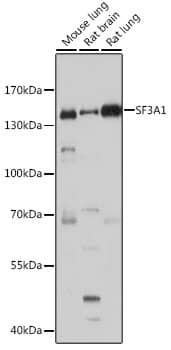 Western Blot: SF3A1 Antibody [NBP3-38091] - Western blot analysis of various lysates using SF3A1 Rabbit pAb at 1:1000 dilution.Secondary antibody: HRP-conjugated Goat anti-Rabbit IgG (H+L) at 1:10000 dilution.Lysates/proteins: 25ug per lane.Blocking buffer: 3% nonfat dry milk in TBST.Detection: ECL Basic Kit.Exposure time: 30s.