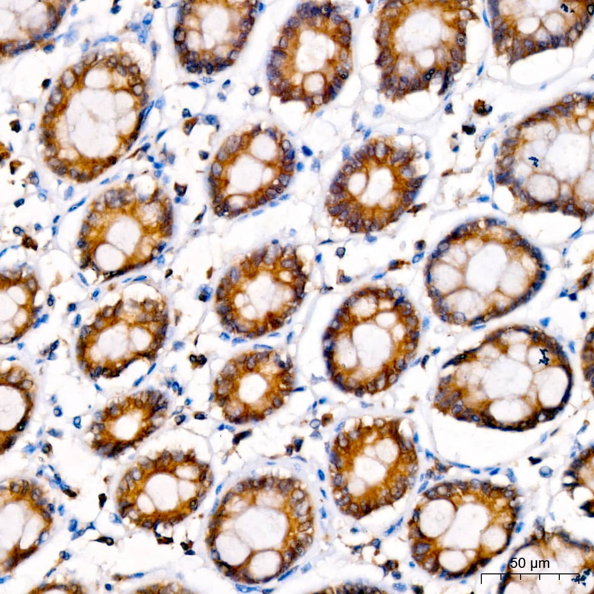 Immunohistochemistry: LYPLA1 Antibody [NBP3-38093] - Immunohistochemistry analysis of paraffin-embedded Human colon tissue using LYPLA1 Rabbit pAb at a dilution of 1:100 (40x lens). High pressure antigen retrieval was performed with 0.01 M citrate buffer (pH 6.0) prior to IHC staining.