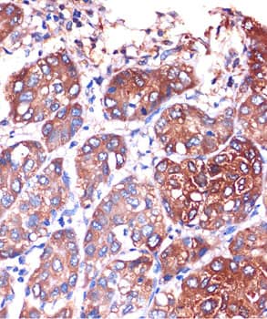 Immunohistochemistry: LYPLA1 Antibody [NBP3-38093] - Immunohistochemistry analysis of paraffin-embedded Human colon tissue using LYPLA1 Rabbit pAb  at a dilution of 1:100 (40x lens). High pressure antigen retrieval was performed with 0.01 M citrate buffer (pH 6.0) prior to IHC staining.