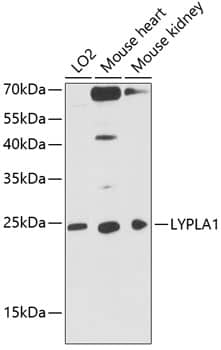 Western Blot: LYPLA1 Antibody [NBP3-38093] - Western blot analysis of various lysates using LYPLA1 Rabbit pAb at 1:1000 dilution. Secondary antibody: HRP-conjugated Goat anti-Rabbit IgG (H+L) at 1:10000 dilution. Lysates / proteins: 25 ug per lane. Blocking buffer: 3 % nonfat dry milk in TBST. Detection: ECL Basic Kit. Exposure time: 90s.