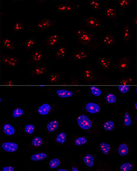 Immunocytochemistry/ Immunofluorescence: MYBBP1A Antibody [NBP3-38094] - Confocal immunofluorescence analysis of U2OS cells using MYBBP1A Rabbit pAb at dilution of 1:200. Blue: DAPI for nuclear staining.