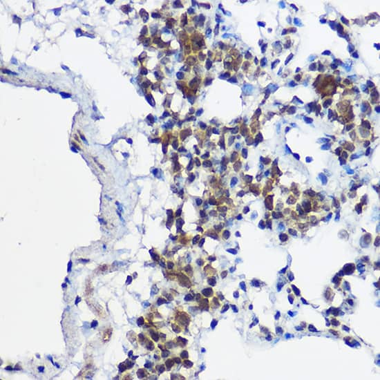 Immunohistochemistry MYBBP1A Antibody