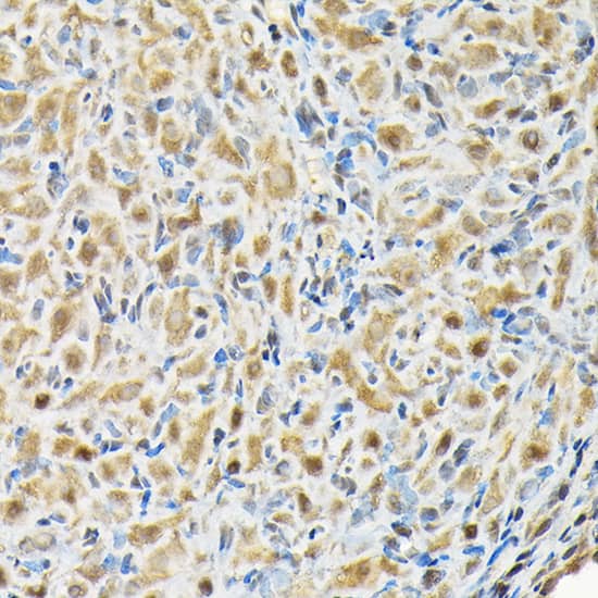 Immunohistochemistry: RBBP9 Antibody [NBP3-38095] - Immunohistochemistry analysis of paraffin-embedded Rat ovary using RBBP9 Rabbit pAb at dilution of 1:200 (40x lens). High pressure antigen retrieval performed with 0.01M Citrate Bufferr (pH 6.0) prior to IHC staining.