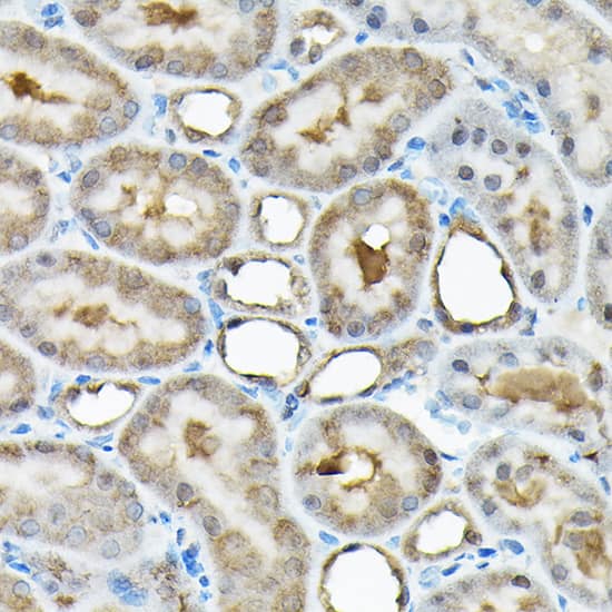 Immunohistochemistry: RBBP9 Antibody [NBP3-38095] - Immunohistochemistry analysis of paraffin-embedded Rat kidney using RBBP9 Rabbit pAb at dilution of 1:200 (40x lens). High pressure antigen retrieval performed with 0.01M Citrate Bufferr (pH 6.0) prior to IHC staining.