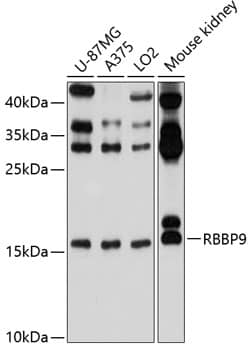 Western Blot: RBBP9 Antibody [NBP3-38095] - Western blot analysis of various lysates using RBBP9 Rabbit pAb at 1:1000 dilution.Secondary antibody: HRP-conjugated Goat anti-Rabbit IgG (H+L) at 1:10000 dilution.Lysates/proteins: 25ug per lane.Blocking buffer: 3% nonfat dry milk in TBST.Detection: ECL Basic Kit.Exposure time: 10s.