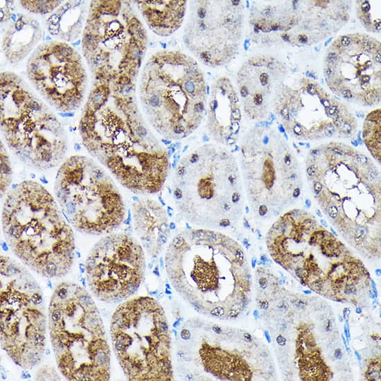 Immunohistochemistry: ADRM1 Antibody [NBP3-38097] - Immunohistochemistry analysis of paraffin-embedded Mouse kidney using ADRM1 Rabbit pAb at dilution of 1:100 (40x lens). High pressure antigen retrieval performed with 0.01M Citrate Bufferr (pH 6.0) prior to IHC staining.