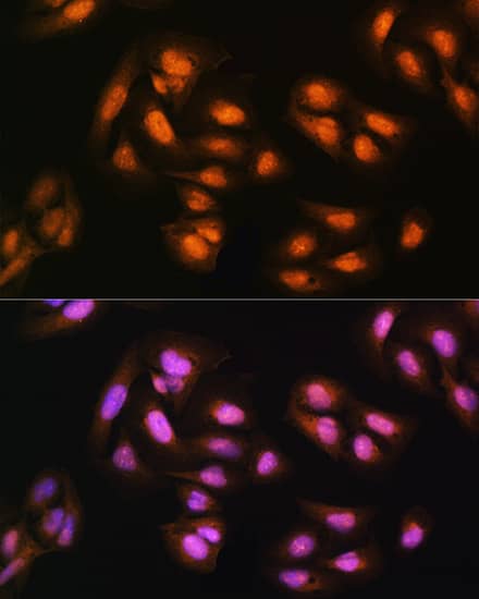 Immunocytochemistry/ Immunofluorescence: ADRM1 Antibody [NBP3-38097] - Immunofluorescence analysis of U2OS cells using ADRM1 Rabbit pAb at dilution of 1:100. Secondary antibody: Cy3-conjugated Goat anti-Rabbit IgG (H+L) at 1:500 dilution. Blue: DAPI for nuclear staining.