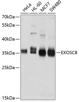 Western Blot: Exosome component 8 Antibody [NBP3-38100] - Western blot analysis of various lysates using Exosome component 8 Rabbit pAb at 1:1000 dilution.Secondary antibody: HRP-conjugated Goat anti-Rabbit IgG (H+L) at 1:10000 dilution.Lysates/proteins: 25ug per lane.Blocking buffer: 3% nonfat dry milk in TBST.Detection: ECL Basic Kit.Exposure time: 1s.