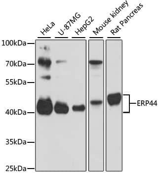 Western Blot: ERP44 Antibody [NBP3-38101] - Western blot analysis of various lysates using ERP44 Rabbit pAb at 1:3000 dilution.Secondary antibody: HRP-conjugated Goat anti-Rabbit IgG (H+L) at 1:10000 dilution.Lysates/proteins: 25ug per lane.Blocking buffer: 3% nonfat dry milk in TBST.Detection: ECL Basic Kit.Exposure time: 30s.