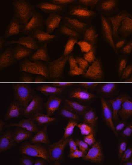 Immunocytochemistry/ Immunofluorescence: NCAPH Antibody [NBP3-38103] - Immunofluorescence analysis of U2OS cells using NCAPH Rabbit pAb at dilution of 1:100. Secondary antibody: Cy3-conjugated Goat anti-Rabbit IgG (H+L) at 1:500 dilution. Blue: DAPI for nuclear staining.