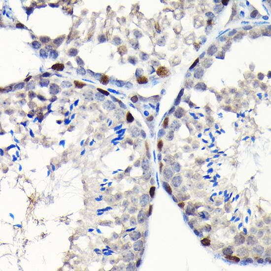 Immunohistochemistry GTPBP4 Antibody