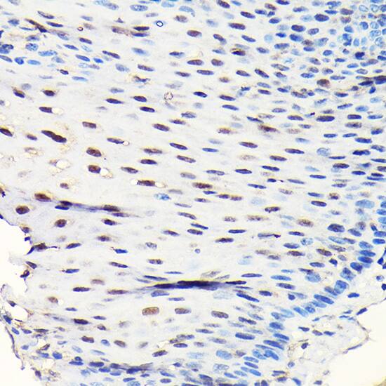 Immunohistochemistry: GTPBP4 Antibody [NBP3-38104] - Immunohistochemistry analysis of paraffin-embedded Human esophageal using GTPBP4 Rabbit pAb at dilution of 1:50 (40x lens). High pressure antigen retrieval performed with 0.01M Citrate Bufferr (pH 6.0) prior to IHC staining.