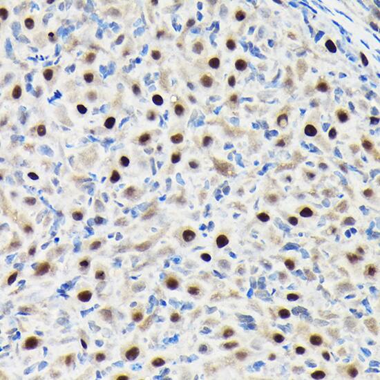 Immunohistochemistry GTPBP4 Antibody