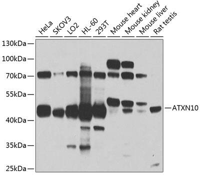 Western Blot: Ataxin-10 Antibody [NBP3-38105] - Western blot analysis of various lysates using Ataxin-10 Rabbit pAb at 1:1000 dilution.Secondary antibody: HRP-conjugated Goat anti-Rabbit IgG (H+L) at 1:10000 dilution.Lysates/proteins: 25ug per lane.Blocking buffer: 3% nonfat dry milk in TBST.Detection: ECL Basic Kit.Exposure time: 90s.