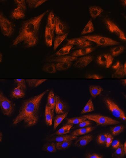 Immunocytochemistry/ Immunofluorescence: Ataxin-10 Antibody [NBP3-38105] - Immunofluorescence analysis of H9C2 cells using Ataxin-10 Rabbit pAb at dilution of 1:100. Secondary antibody: Cy3-conjugated Goat anti-Rabbit IgG (H+L) at 1:500 dilution. Blue: DAPI for nuclear staining.