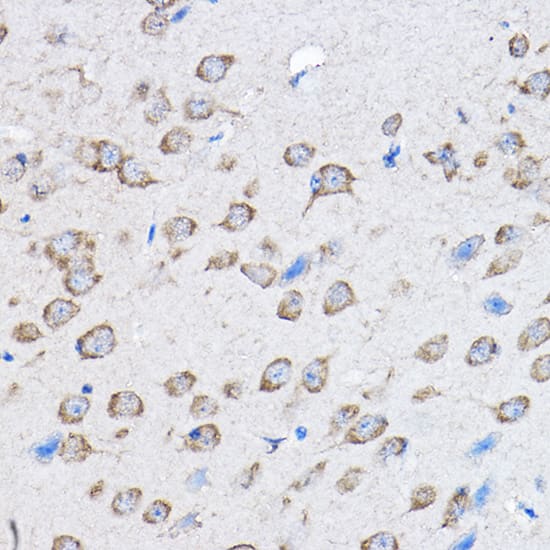 Immunohistochemistry PTPN23 Antibody