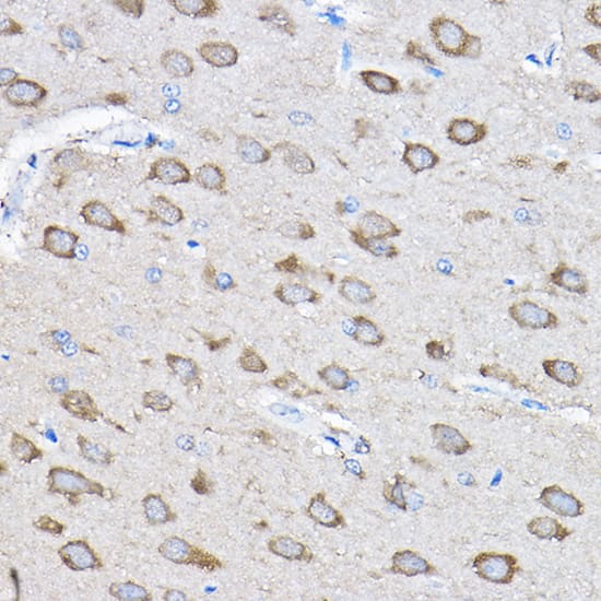 Immunohistochemistry PTPN23 Antibody