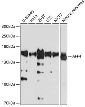 Western Blot: AFF4 Antibody [NBP3-38108] - Western blot analysis of various lysates using AFF4 Rabbit pAb at 1:1000 dilution.Secondary antibody: HRP-conjugated Goat anti-Rabbit IgG (H+L) at 1:10000 dilution.Lysates/proteins: 25ug per lane.Blocking buffer: 3% nonfat dry milk in TBST.Detection: ECL Basic Kit.Exposure time: 30s.