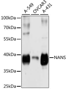 Western Blot: NANS Antibody [NBP3-38112] - Western blot analysis of various lysates using NANS Rabbit pAb at 1:3000 dilution.Secondary antibody: HRP-conjugated Goat anti-Rabbit IgG (H+L) at 1:10000 dilution.Lysates/proteins: 25ug per lane.Blocking buffer: 3% nonfat dry milk in TBST.Detection: ECL Basic Kit.Exposure time: 5s.