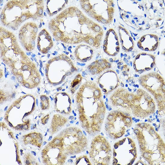 Immunohistochemistry: CC2D1A Antibody [NBP3-38114] - Immunohistochemistry analysis of paraffin-embedded Rat kidney using CC2D1A Rabbit pAb at dilution of 1:200 (40x lens). High pressure antigen retrieval performed with 0.01M Citrate Bufferr (pH 6.0) prior to IHC staining.