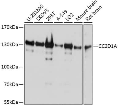 Western Blot: CC2D1A Antibody [NBP3-38114] - Western blot analysis of various lysates using CC2D1A Rabbit pAb at 1:1000 dilution.Secondary antibody: HRP-conjugated Goat anti-Rabbit IgG (H+L) at 1:10000 dilution.Lysates/proteins: 25ug per lane.Blocking buffer: 3% nonfat dry milk in TBST.Detection: ECL Basic Kit.Exposure time: 1s.