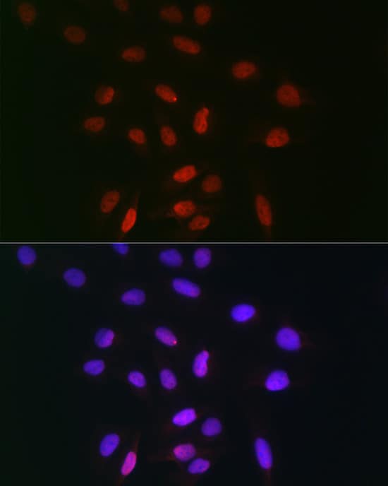 Immunocytochemistry/ Immunofluorescence: TDP1 Antibody [NBP3-38115] - Immunofluorescence analysis of U-2 OS cells using TDP1 Rabbit pAb at dilution of 1:100 (40x lens). Secondary antibody: Cy3-conjugated Goat anti-Rabbit IgG (H+L) at 1:500 dilution. Blue: DAPI for nuclear staining.