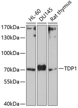 Western Blot: TDP1 Antibody [NBP3-38115] - Western blot analysis of various lysates using TDP1 Rabbit pAb at 1:1000 dilution.Secondary antibody: HRP-conjugated Goat anti-Rabbit IgG (H+L) at 1:10000 dilution.Lysates/proteins: 25ug per lane.Blocking buffer: 3% nonfat dry milk in TBST.Detection: ECL Basic Kit.Exposure time: 90s.