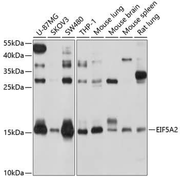 Western Blot: eIF5A2 Antibody [NBP3-38116] - Western blot analysis of various lysates using eIF5A2 Rabbit pAb at 1:1000 dilution.Secondary antibody: HRP-conjugated Goat anti-Rabbit IgG (H+L) at 1:10000 dilution.Lysates/proteins: 25ug per lane.Blocking buffer: 3% nonfat dry milk in TBST.Detection: ECL Basic Kit.Exposure time: 30s.