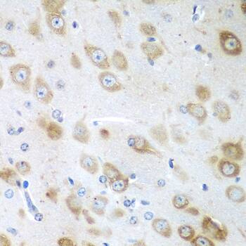 Immunohistochemistry: GFM1 Antibody [NBP3-38121] - Immunohistochemistry analysis of paraffin-embedded Mouse brain using GFM1 Rabbit pAb at dilution of 1:100 (40x lens). Microwave antigen retrieval performed with 0.01M PBS Buffer (pH 7.2) prior to IHC staining.