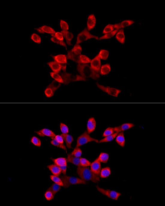 Immunocytochemistry/ Immunofluorescence LARP4 Antibody - BSA Free