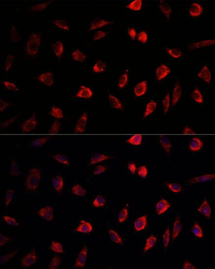 Immunocytochemistry/ Immunofluorescence: NEDD1 Antibody [NBP3-38124] - Immunofluorescence analysis of L929 cells using NEDD1 Rabbit pAb at dilution of 1:100. Secondary antibody: Cy3-conjugated Goat anti-Rabbit IgG (H+L) at 1:500 dilution. Blue: DAPI for nuclear staining.