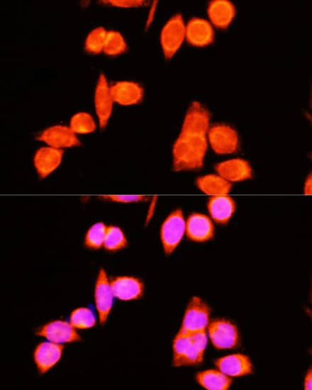 Immunocytochemistry/ Immunofluorescence: DNAJC19 Antibody [NBP3-38125] - Immunofluorescence analysis of Hela cells using DNAJC19 Rabbit pAb at dilution of 1:100 (40x lens). Secondary antibody: Cy3-conjugated Goat anti-Rabbit IgG (H+L) at 1:500 dilution. Blue: DAPI for nuclear staining.