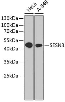 Western Blot: SESN3 Antibody [NBP3-38126] - Western blot analysis of various lysates using SESN3 Rabbit pAb at 1:1000 dilution.Secondary antibody: HRP-conjugated Goat anti-Rabbit IgG (H+L) at 1:10000 dilution.Lysates/proteins: 25ug per lane.Blocking buffer: 3% nonfat dry milk in TBST.Detection: ECL Basic Kit.Exposure time: 60s.