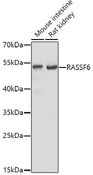 Western Blot: RASSF6 Antibody [NBP3-38127] - Western blot analysis of various lysates using RASSF6 Rabbit pAb at 1:1000 dilution.Secondary antibody: HRP-conjugated Goat anti-Rabbit IgG (H+L) at 1:10000 dilution.Lysates/proteins: 25ug per lane.Blocking buffer: 3% nonfat dry milk in TBST.Detection: ECL Basic Kit.Exposure time: 15s.