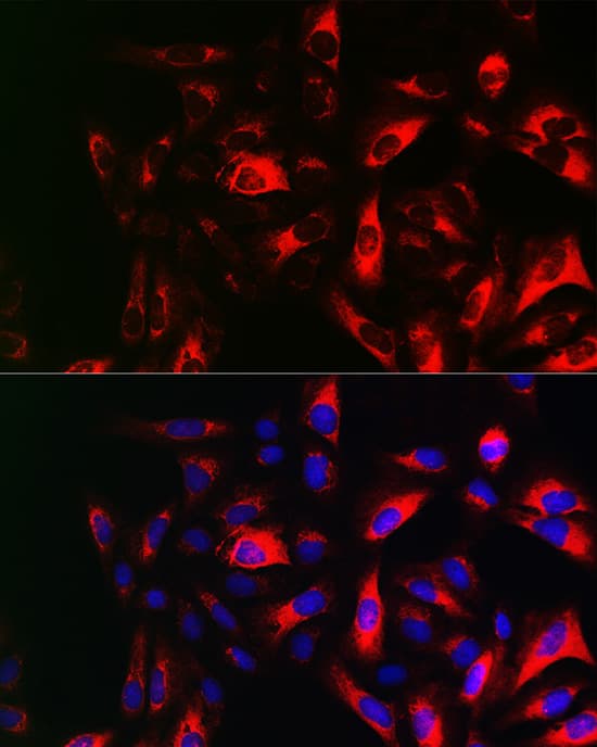 Immunocytochemistry/ Immunofluorescence: RRM2 Antibody [NBP3-38129] - Immunofluorescence analysis of U2OS cells using RRM2 Rabbit pAb at dilution of 1:100 (40x lens). Secondary antibody: Cy3-conjugated Goat anti-Rabbit IgG (H+L) at 1:500 dilution. Blue: DAPI for nuclear staining.