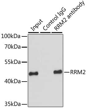 Immunoprecipitation: RRM2 Antibody [NBP3-38129] - Immunoprecipitation analysis of 200 ug extracts of HeLa cells using RRM2 antibody. Western blot was performed from the immunoprecipitate using RRM2 antibody at a dilution of 1:1000.