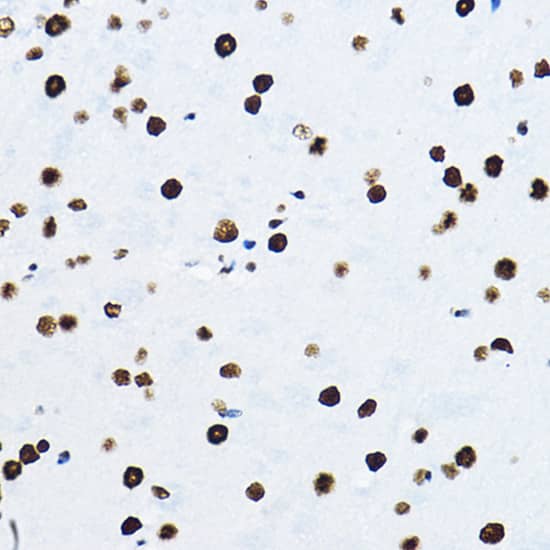 Immunohistochemistry: NONO Antibody [NBP3-38132] - Immunohistochemistry analysis of paraffin-embedded Mouse brain using NONO Rabbit pAb at dilution of 1:100 (40x lens). High pressure antigen retrieval performed with 0.01M Citrate Bufferr (pH 6.0) prior to IHC staining.