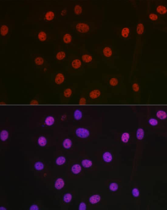 Immunocytochemistry/ Immunofluorescence: NONO Antibody [NBP3-38132] - Immunofluorescence analysis of NIH-3T3 cells using NONO Rabbit pAb at dilution of 1:100 (40x lens). Secondary antibody: Cy3-conjugated Goat anti-Rabbit IgG (H+L) at 1:500 dilution. Blue: DAPI for nuclear staining.