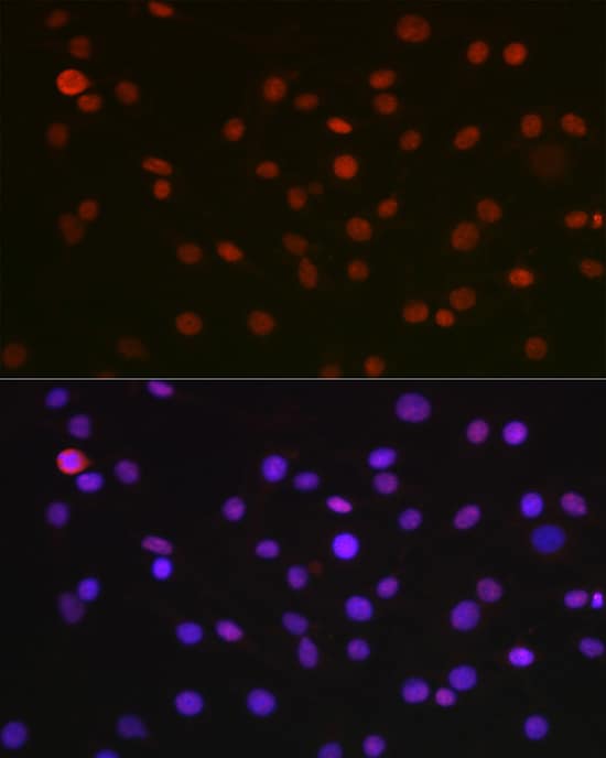 Immunocytochemistry/ Immunofluorescence: NONO Antibody [NBP3-38132] - Immunofluorescence analysis of C6 cells using NONO Rabbit pAb at dilution of 1:100 (40x lens). Secondary antibody: Cy3-conjugated Goat anti-Rabbit IgG (H+L) at 1:500 dilution. Blue: DAPI for nuclear staining.