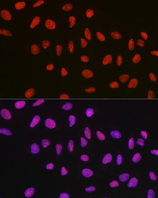 Immunocytochemistry/ Immunofluorescence: NONO Antibody [NBP3-38132] - Immunofluorescence analysis of U-2 OS cells using NONO Rabbit pAb at dilution of 1:100 (40x lens). Secondary antibody: Cy3-conjugated Goat anti-Rabbit IgG (H+L) at 1:500 dilution. Blue: DAPI for nuclear staining.