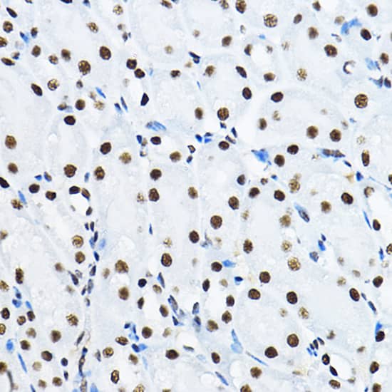 Immunohistochemistry: NONO Antibody [NBP3-38132] - Immunohistochemistry analysis of paraffin-embedded Mouse kidney using NONO Rabbit pAb at dilution of 1:100 (40x lens). High pressure antigen retrieval performed with 0.01M Citrate Bufferr (pH 6.0) prior to IHC staining.