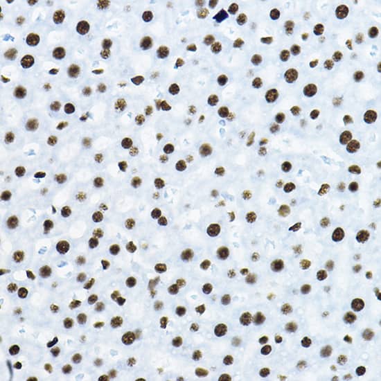 Immunohistochemistry: NONO Antibody [NBP3-38132] - Immunohistochemistry analysis of paraffin-embedded Rat liver using NONO Rabbit pAb at dilution of 1:100 (40x lens). High pressure antigen retrieval performed with 0.01M Citrate Bufferr (pH 6.0) prior to IHC staining.