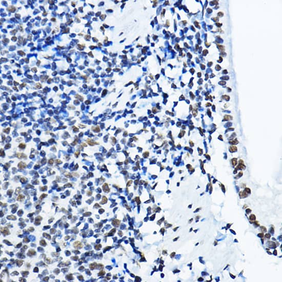 Immunohistochemistry: NONO Antibody [NBP3-38132] - Immunohistochemistry analysis of paraffin-embedded Rat lung using NONO Rabbit pAb at dilution of 1:100 (40x lens). High pressure antigen retrieval performed with 0.01M Citrate Bufferr (pH 6.0) prior to IHC staining.