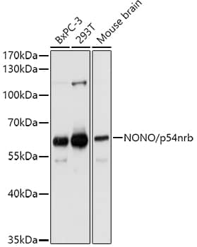 Western Blot: NONO Antibody [NBP3-38132] - Western blot analysis of various lysates using NONO Rabbit pAb at 1:1000 dilution.Secondary antibody: HRP-conjugated Goat anti-Rabbit IgG (H+L) at 1:10000 dilution.Lysates/proteins: 25ug per lane.Blocking buffer: 3% nonfat dry milk in TBST.Detection: ECL Basic Kit.Exposure time: 10s.