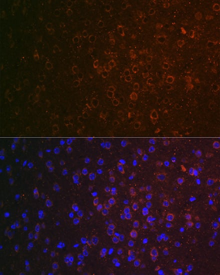 Immunocytochemistry/ Immunofluorescence: ABAT Antibody [NBP3-38133] - Immunofluorescence analysis of paraffin-embedded mouse brain using ABAT(GABA transaminase) Rabbit pAb at dilution of 1:100 (40x lens). Secondary antibody: Cy3-conjugated Goat anti-Rabbit IgG (H+L) at 1:500 dilution. Blue: DAPI for nuclear staining.