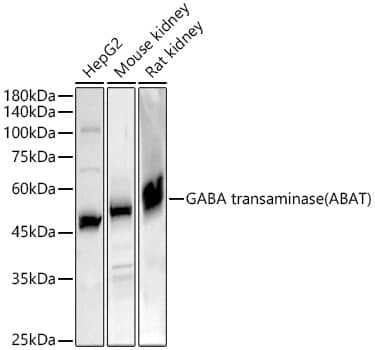 Western Blot: ABAT Antibody [NBP3-38133] - Western blot analysis of various lysates, using ABATRabbit pAb at 1:1000 dilution.Secondary antibody: HRP-conjugated Goat anti-Rabbit IgG (H+L) at 1:10000 dilution.Lysates/proteins: 25ug per lane.Blocking buffer: 3% nonfat dry milk in TBST.Detection: ECL Basic Kit.Exposure time: 10s.